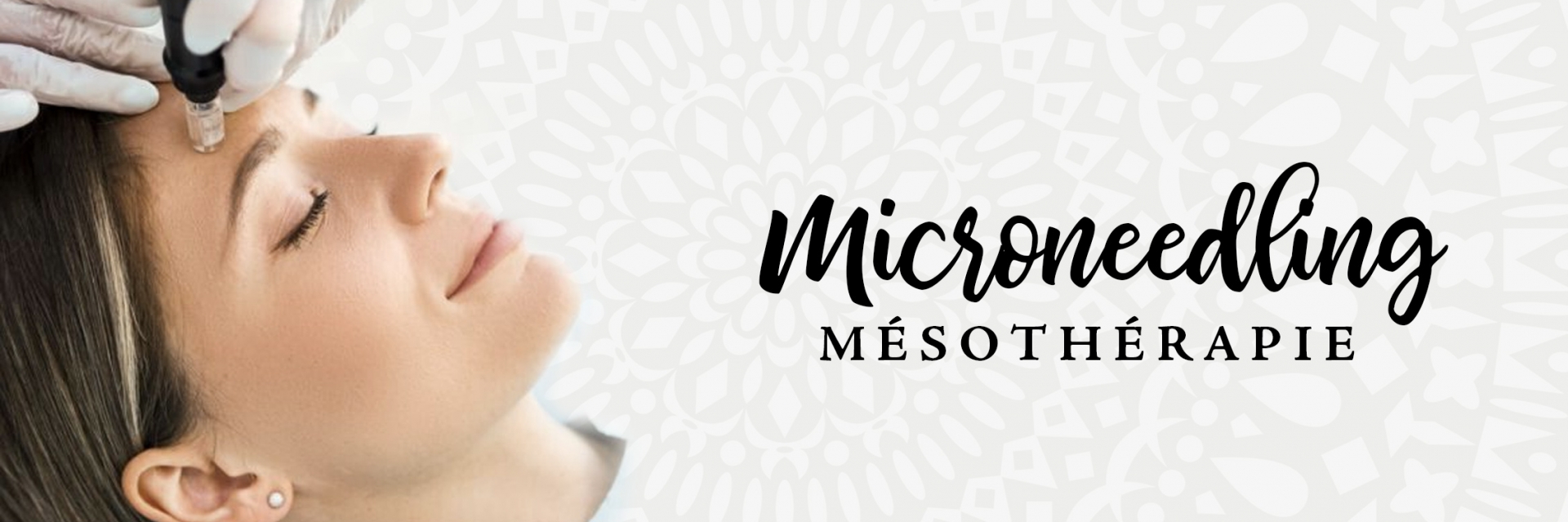 Microneedling