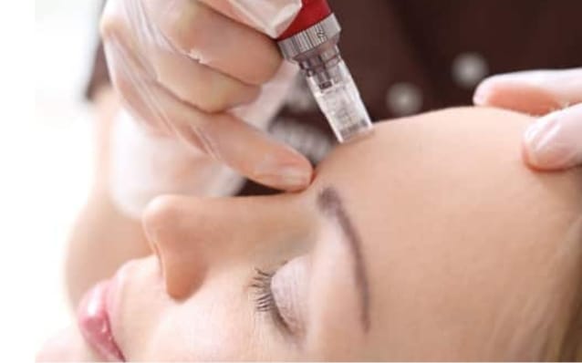 Microneedling - Mésothérapie non-médicale